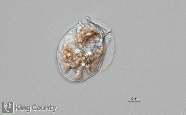 Photo of Dinophysis acuminata